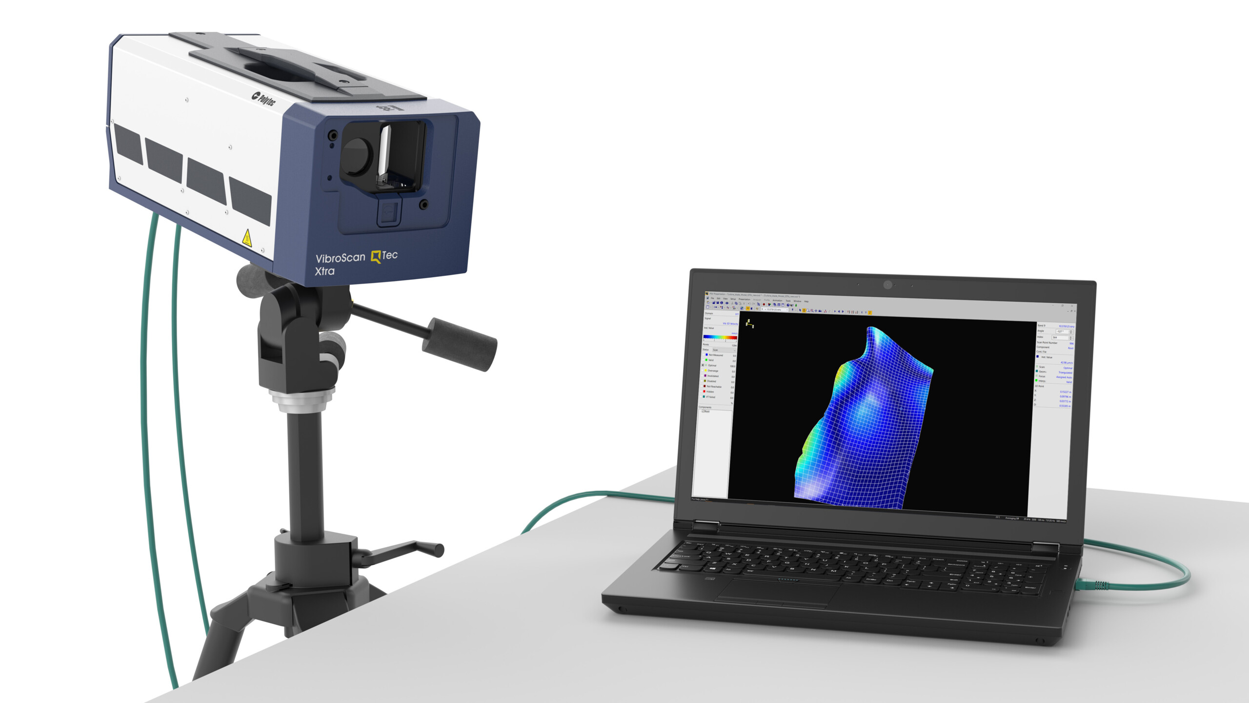 VibroScan_QTec_Xtra_Laptop_scr