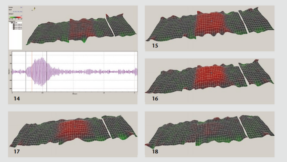 Vibrational deflection shapes of a high-frequency ultrasonic transducer Vibrational deflection shapes of a high-frequency ultrasonic transducer