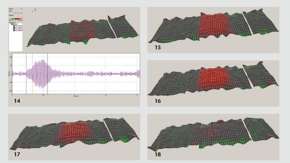Vibrational deflection shapes of a high-frequency ultrasonic transducer Formes de déviation vibratoire d'un transducteur ultrasonique à haute fréquence