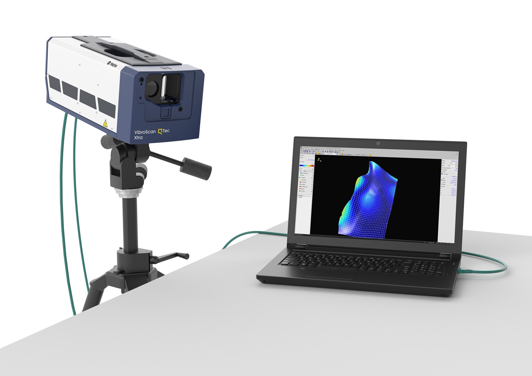 VibroScan QTec Xtra with laptop and PSV Software VibroScan QTec Xtra with laptop and PSV Software